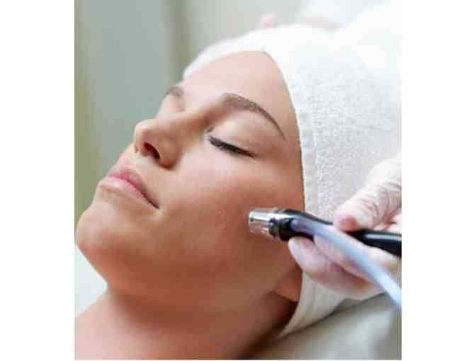 $175 Gift Certificate for a Silk Peel at Dermatology Center of Southern Indiana (B)