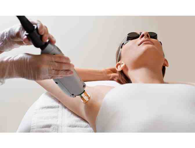 Columbia Laser and Aesthetics | Giftcard for 6 laser sessions