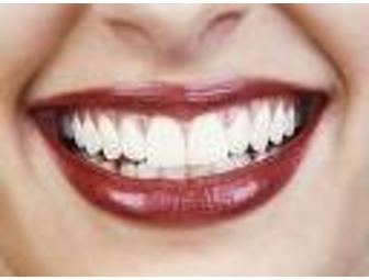 Teeth Whitening - Ochi Dental