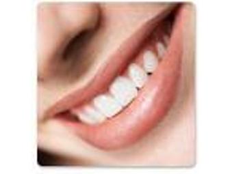 One Lumineer Veneer - Chanel Ko Wiederkehr, DDS