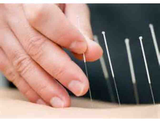 Acupuncture Treatment with Janna Esina, L.Ac., MSTOM - Photo 1